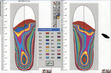 Foot Analysis
